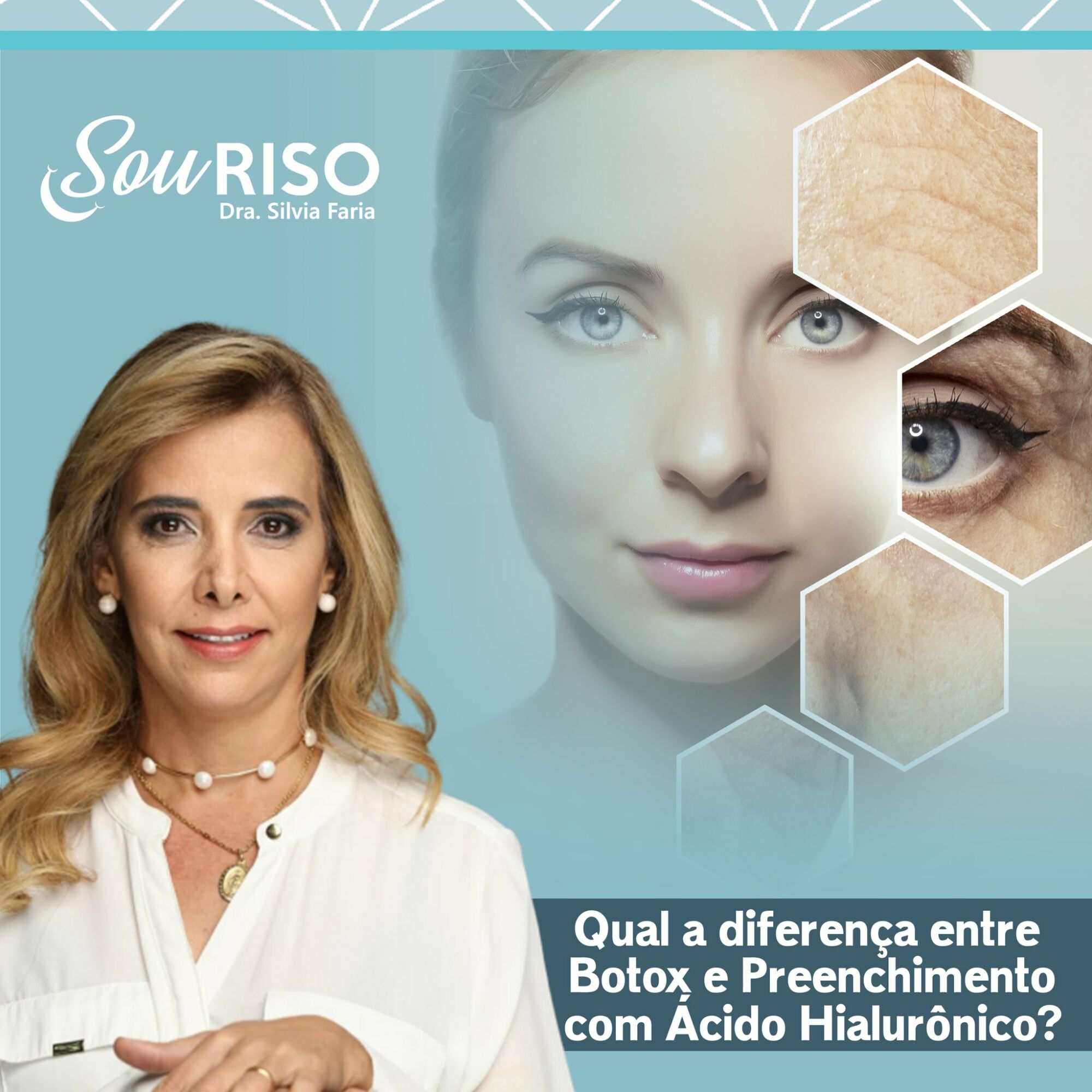 Qual A Diferença Entre Botox E Preenchimento Com Ácido Hialurônico