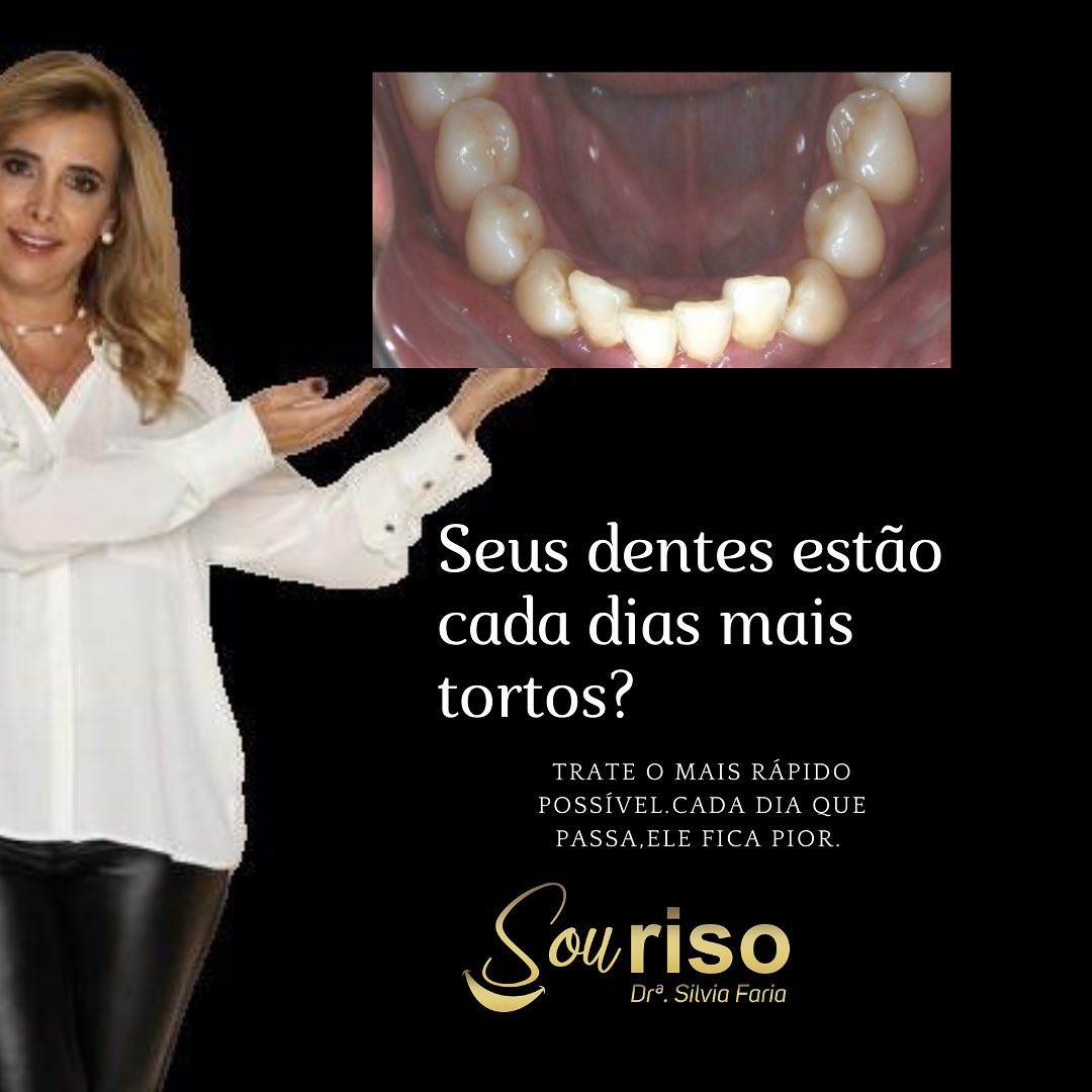 Blog - SouRiso - Dra. Silvia Faria - Paranaíba - MS - Ortodontia