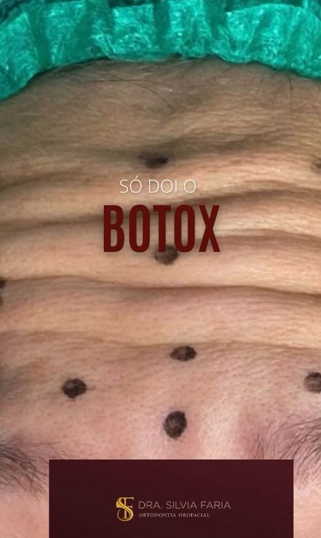 Saiba Por Que a Aplicação de Botox é Quase Indolor