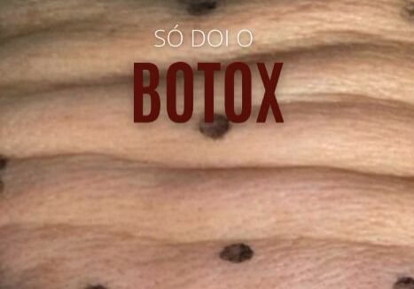 Saiba Por Que a Aplicação de Botox é Quase Indolor
